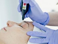 Plasma – bezoperacyjny lifting powiek górnych i dolnych