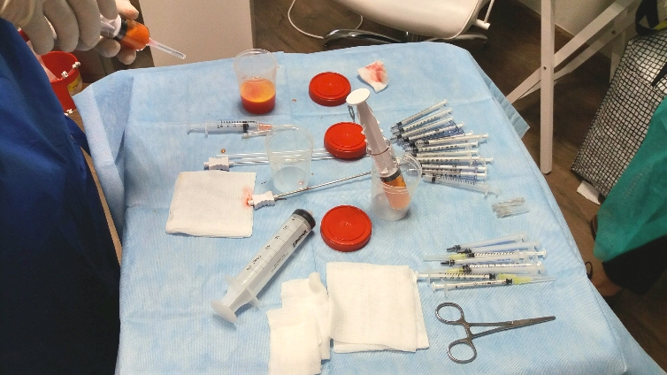Zaawansowane, autorskie szkolenia dla lekarzy z medycyny estetycznej - lipotransfer