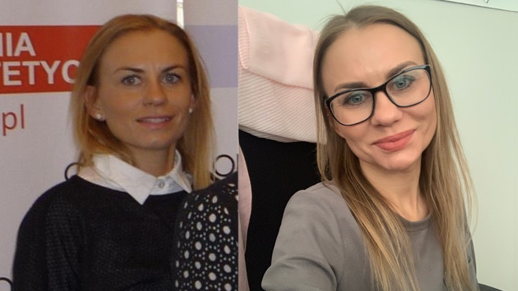 Przed i po zabiegach